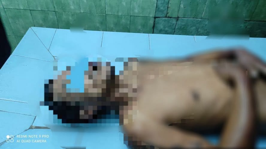 Tahanan Ditemukan Tewas Dengan Kondisi Penuh Lebam di Sekujur Tubuh – Polisi Jawab Tahanan Tewas Polsek Lubuklinggau Utara
