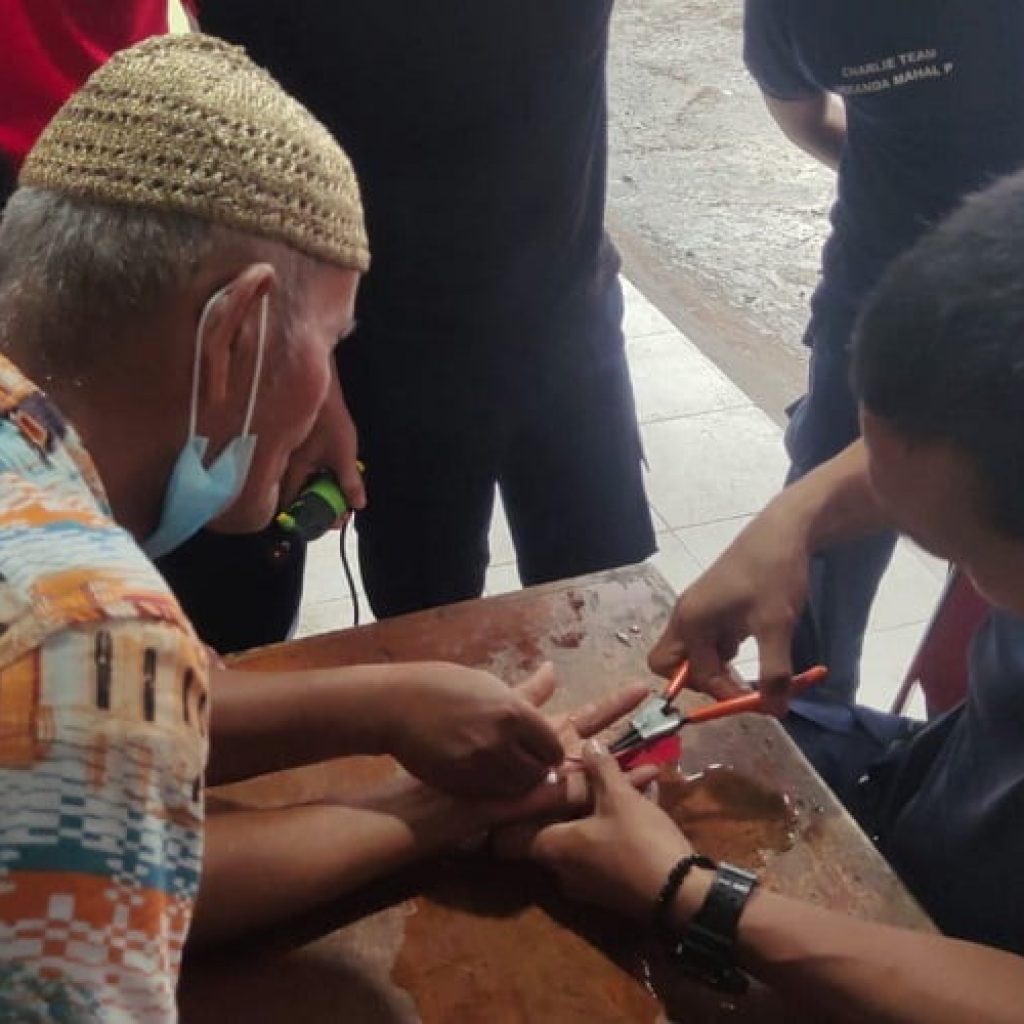 Batu Cincin jenis 'Tapak Jalak' Berikat 'Suaso' Menyiksa Dirinya karena Tak Bisa Lepas