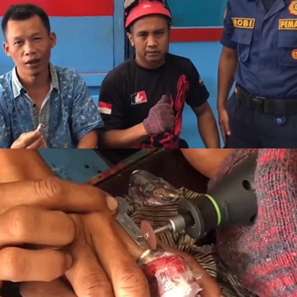 Damkar Kota Padang Berhasil Evakuasi Pelepasan Cincin pada Jari Seorang Pria yang Membengkak