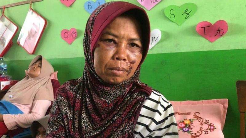 Suryati, salah seorang korban yang selamat dari banjir bandang dan lahar dingin Sumbar yang ditemui di pengungsian.(Foto: Halbert Chaniago)