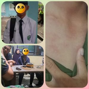 Santri Di Salah Satu Pondok Pesantren Padang Panjang Jadi Korban Kekerasan