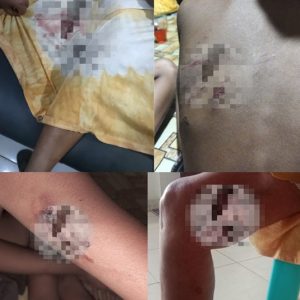 Warga Air Bangis Resah, Anjing Liar Berkeliaran dan Menggigit