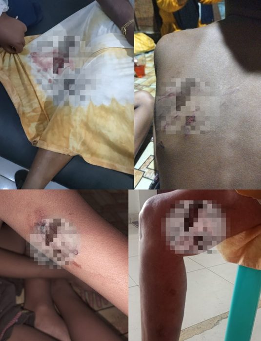 Warga Air Bangis Resah, Anjing Liar Berkeliaran dan Menggigit
