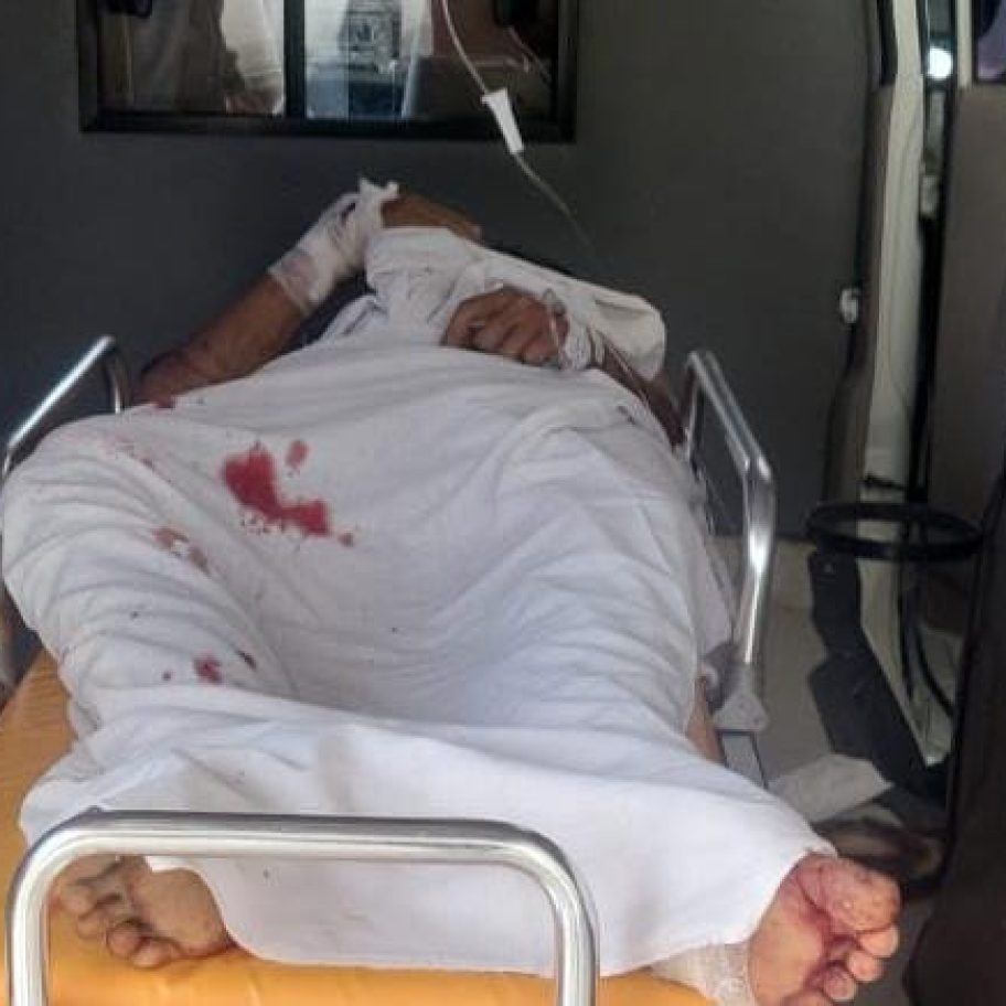 Pria di Pelalawan Diserang Beruang Saat Cari Madu, Selamat Meski Luka Parah di Kepala