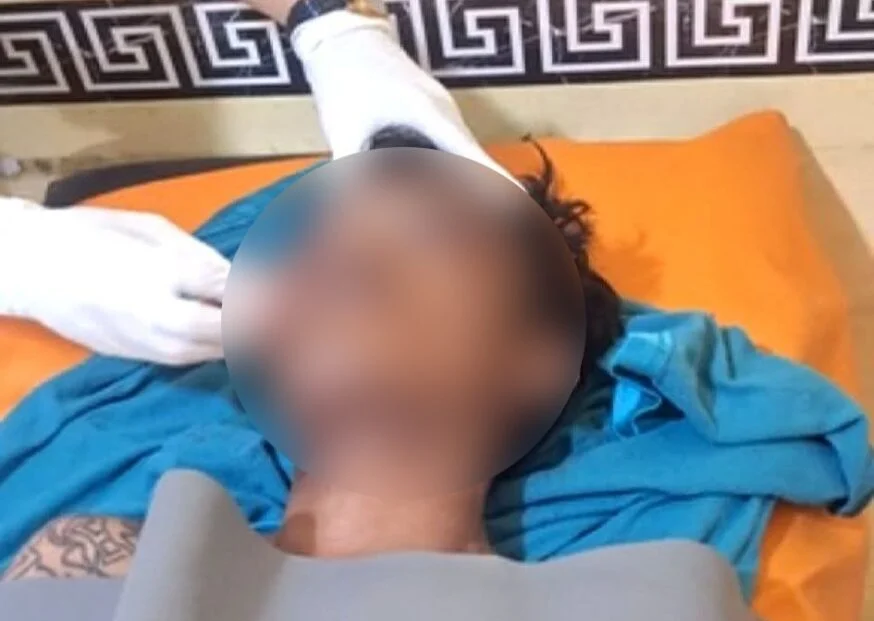 Tragis di Pariaman Penjambret Tewas Diamuk Massa, Seorang Pemotor Ikut Jadi Korban