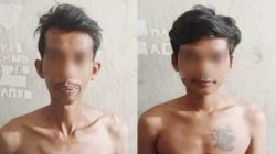 Keponakan di Padang Aniaya Paman Secara Brutal, Emosi Memuncak Karena Terus Ditagih Uang Upah Kerja