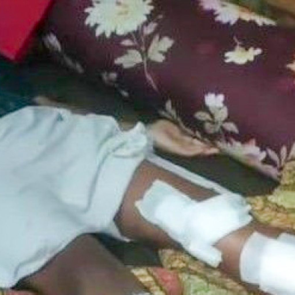 Anak Kelas 2 SD Kritis Ditarik Buaya Saat Mandi di Air Bangis, Pasaman Barat